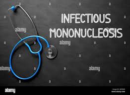 "Mono is unpredictable, so stay proactive!" Take the Quiz On Infectious Mononucleosis thumbnail