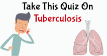 Take This Quiz On Tuberculosis