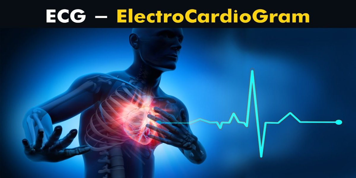 The Technics Of Electrocardiogram thumbnail