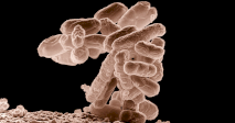 Take This Quiz On Microorganisms!