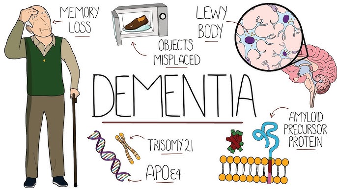 Take an Interesting Quiz on the Disease "Dementia". thumbnail